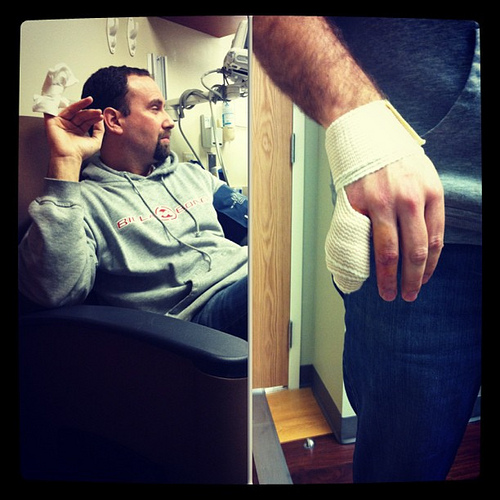 New tool delivered from Amazon today = time spent in the ER with cut pinky. @bgladd